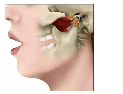 57.png